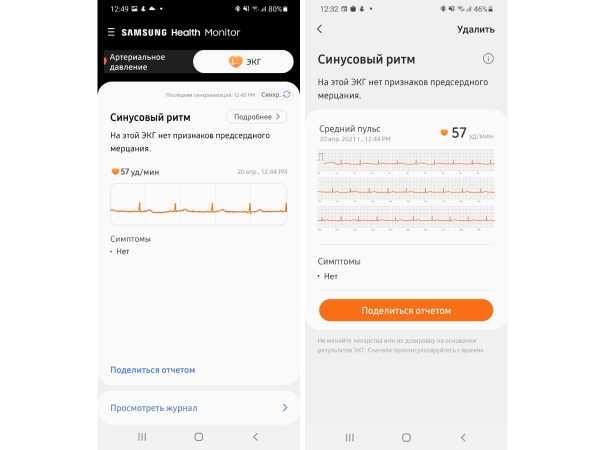 ЭКГ и измерение давления умными часами Samsung: как это работает и можно ли доверять результатам | Журнал Digital World